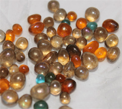 舍利子是結石嗎