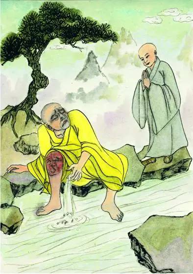 像這樣的業報病，豈是世間的葯所能治好呢！